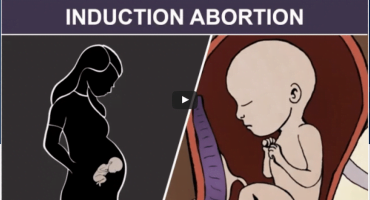 Dirbtinis abortas trečiajame trimestre